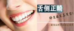 舌侧正畸  一次美牙  终生美观