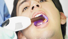 补牙齿用什么材料好