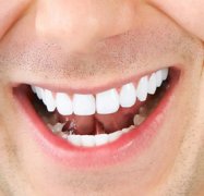孩子矫正牙齿对身体有害吗